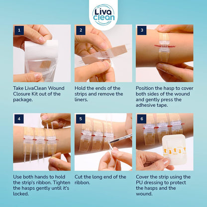 Step-by-step guide on how to use LivaClean wound closure kit with images and text instructions.

