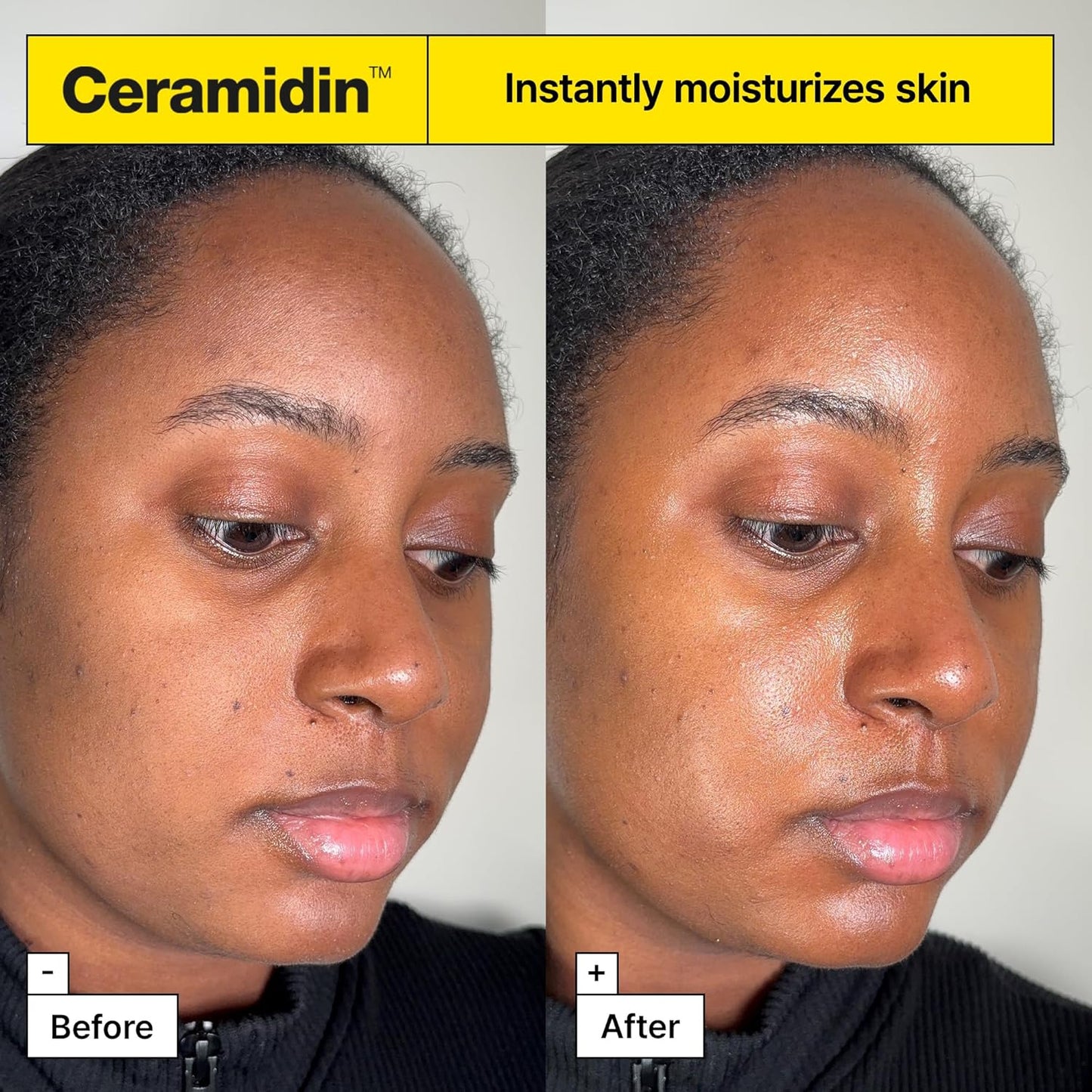 Before and after comparison of a woman's face with Ceramidin moisturizer, showing skin hydration improvement.

