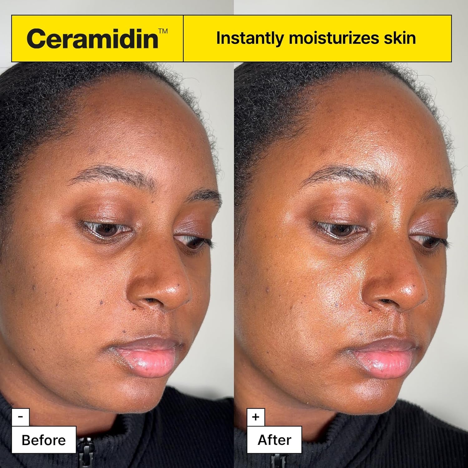 Before and after comparison of a woman's face with Ceramidin moisturizer, showing skin hydration improvement.


